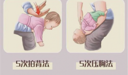 海姆立克急救法视频,关键时刻的救命技能详解