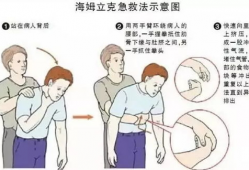 海姆立克急救法视频,关键时刻的救命技能详解